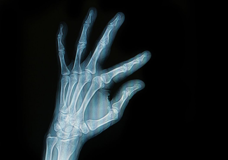 Цифровий рентген – світовий стандарт діагностики