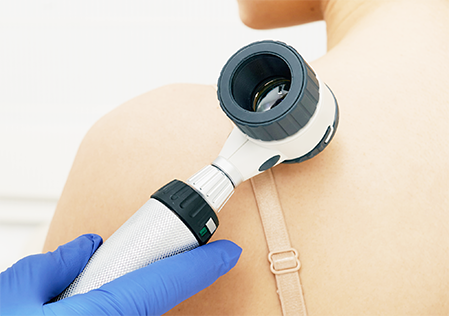 Дерматоскопія – «золотий» стандарт дослідження утворень шкіри