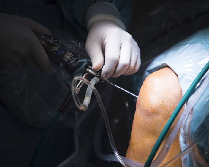 Сучасне малотравматичне лікування суглобів у клініці Medibor