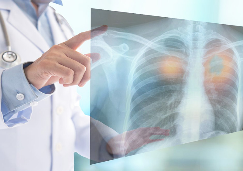 Новий рівень рентген-діагностики у Житомирі – у Медібор