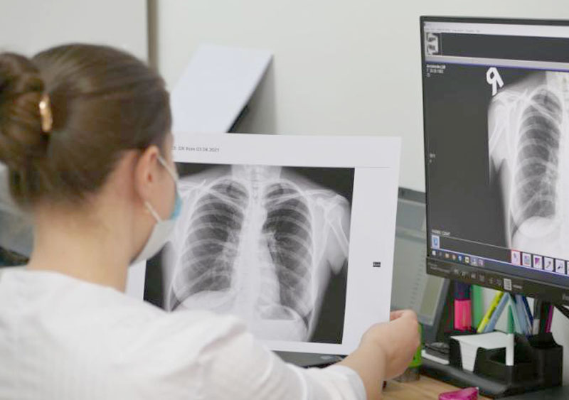 Цифрова рентгенографія в Медібор – вичерпна діагностика для ефективного лікування