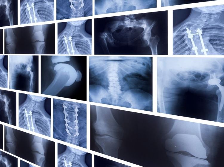 Сучасний цифровий рентген у Medibor: максимальна точність діагностики