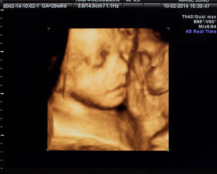 3D УЗД Житомир