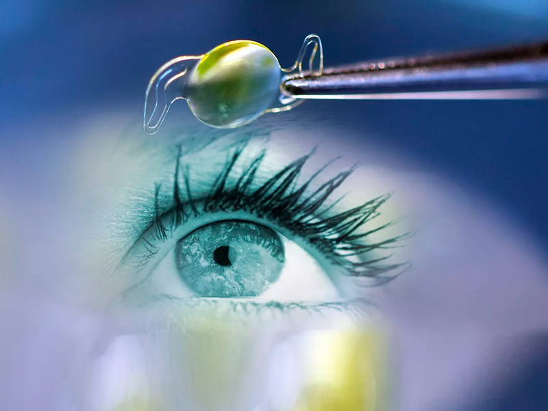 Удаление катаракты в Медибор – безопасно, надежно