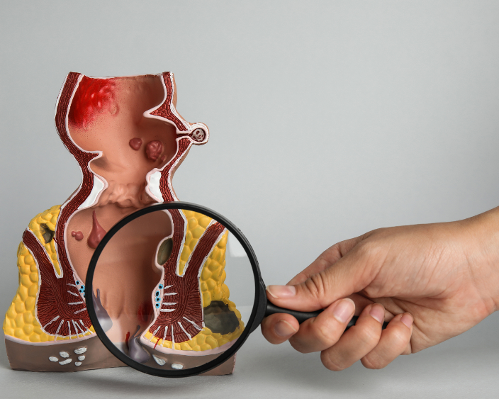 Симптоми проктологічних проблем