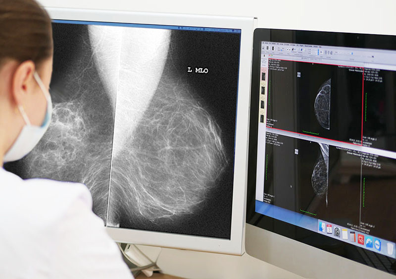 Потурбуйтеся про жіноче здоров’я – пройдіть мамографію