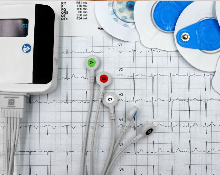 Холтерівське моніторування ЕКГ: коли серце потребує тривалого контролю