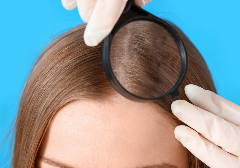 Подбати про здоров’я волосся допоможе трихолог
