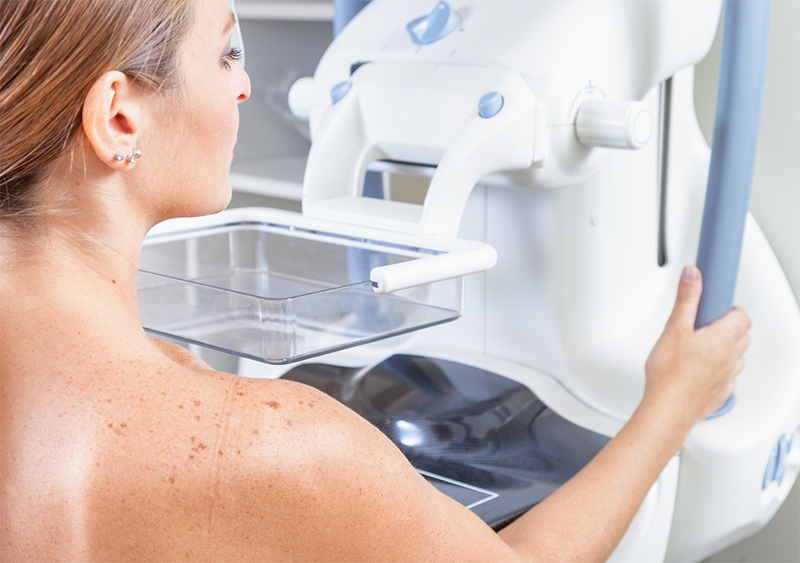 Мамографія: відповіді на найпоширеніші питання