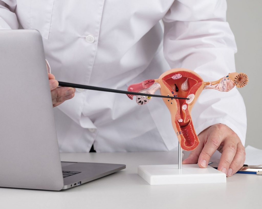 Гістероскопія