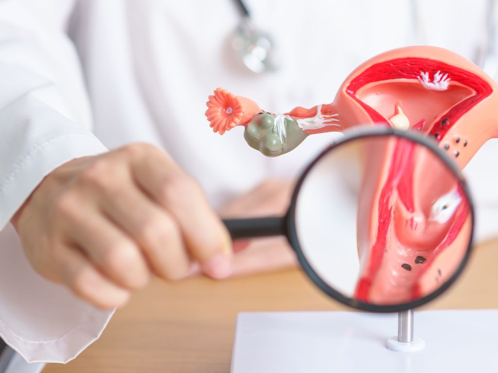 лікування ендометріозу