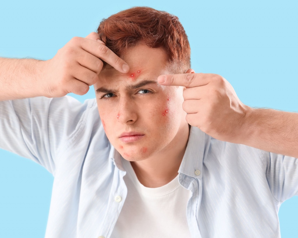 Акне у ребенка