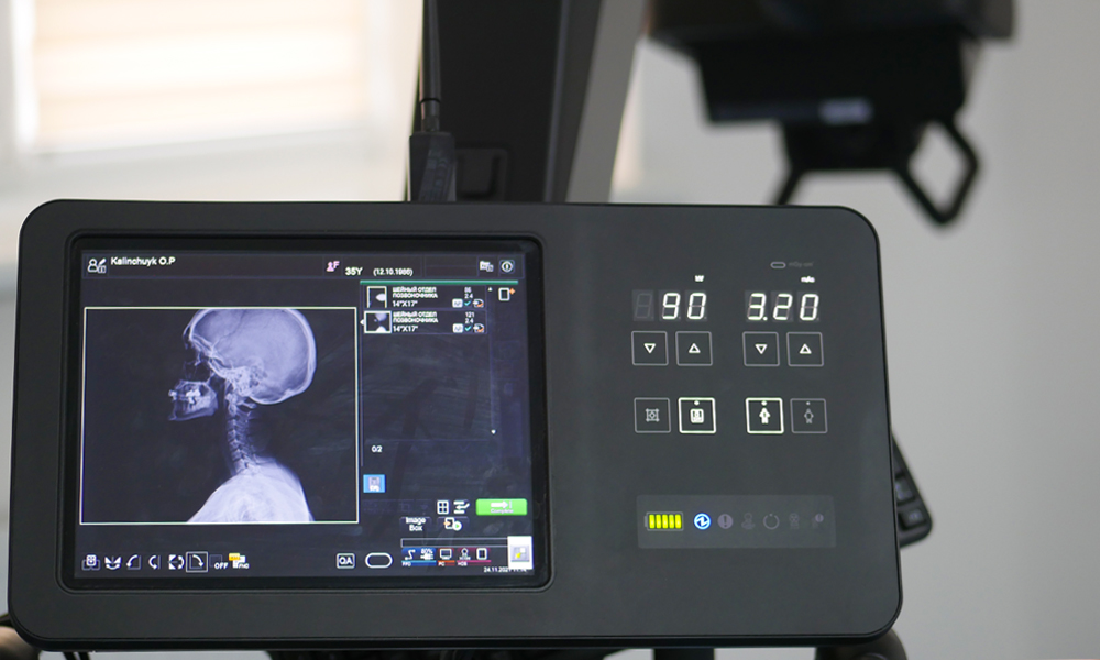 Цифровий рентген з мінімальним рівнем променевого навантаження