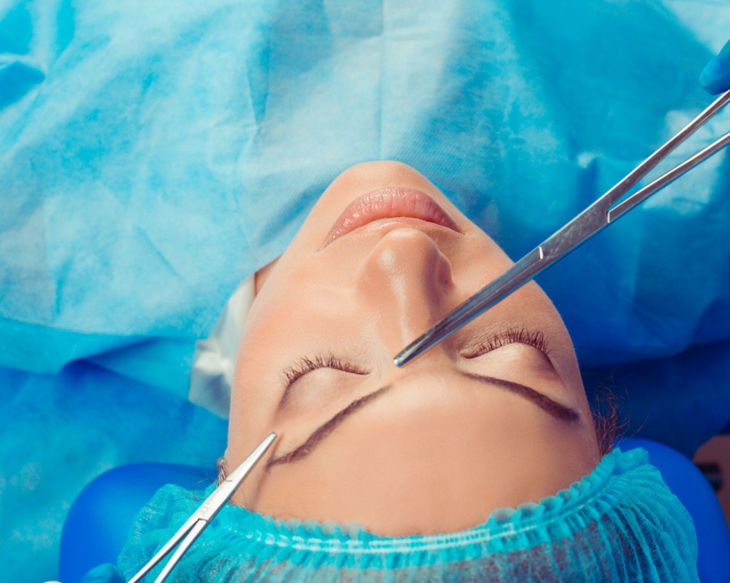 Хірургічна підтяжка брів