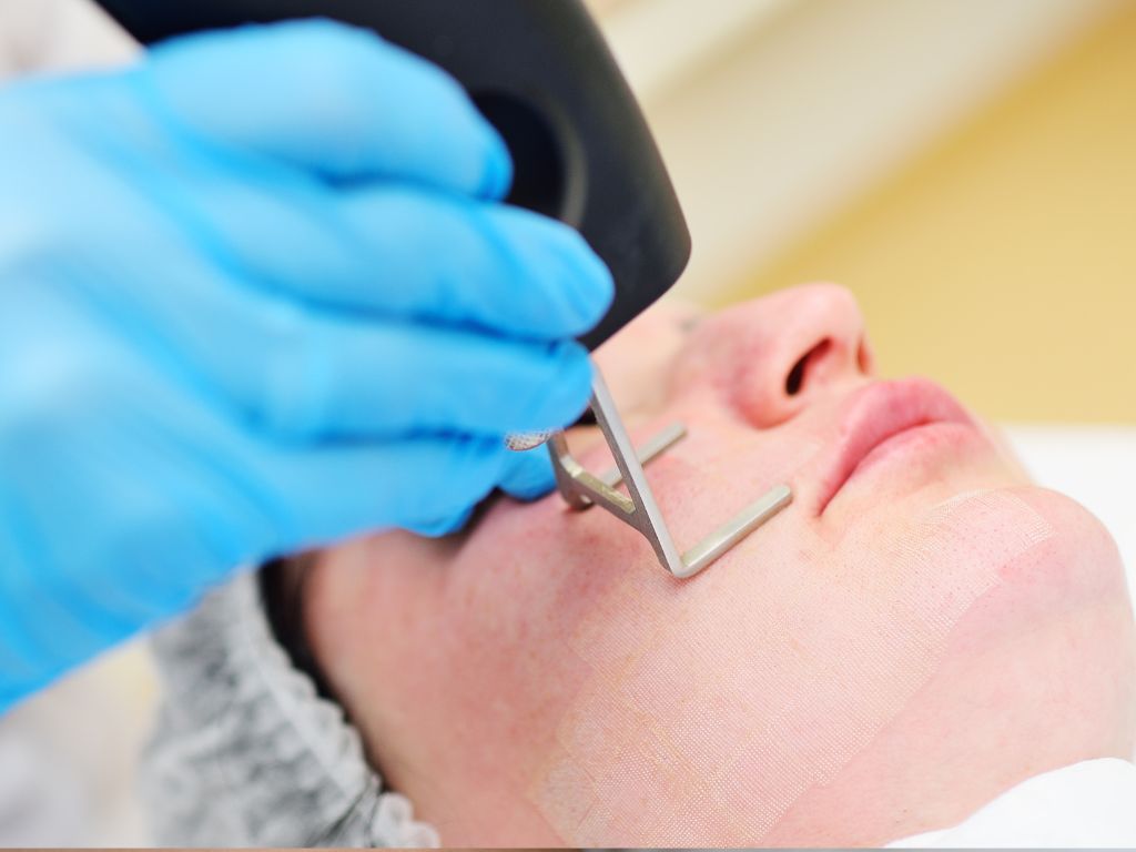 Шліфування лазером постакне Житомир