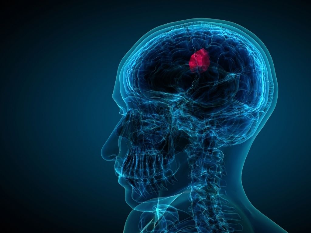 Рентген турецького сідла (гіпофіза)