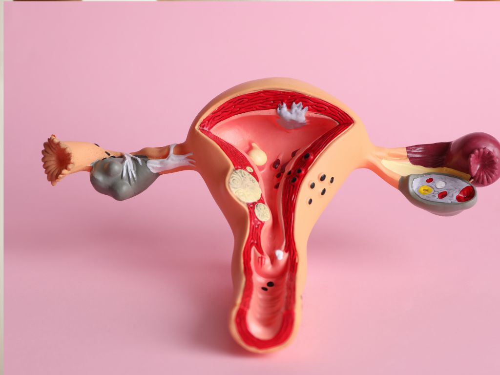 Криолечение патологий шейки матки