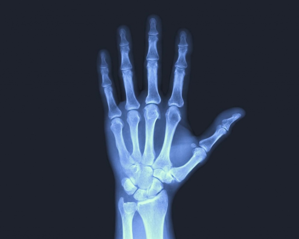 Рентген кисті руки в Житомирі