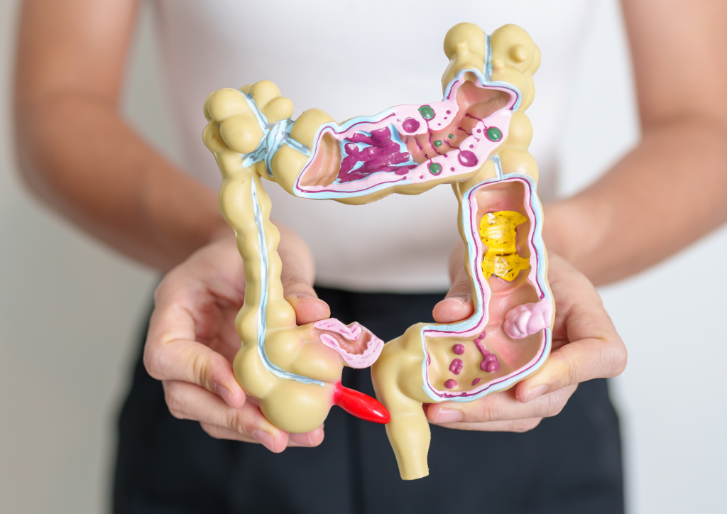 Рак кишківника