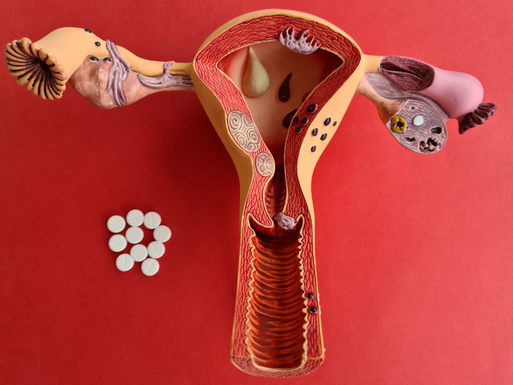 Как вылечить эктопию