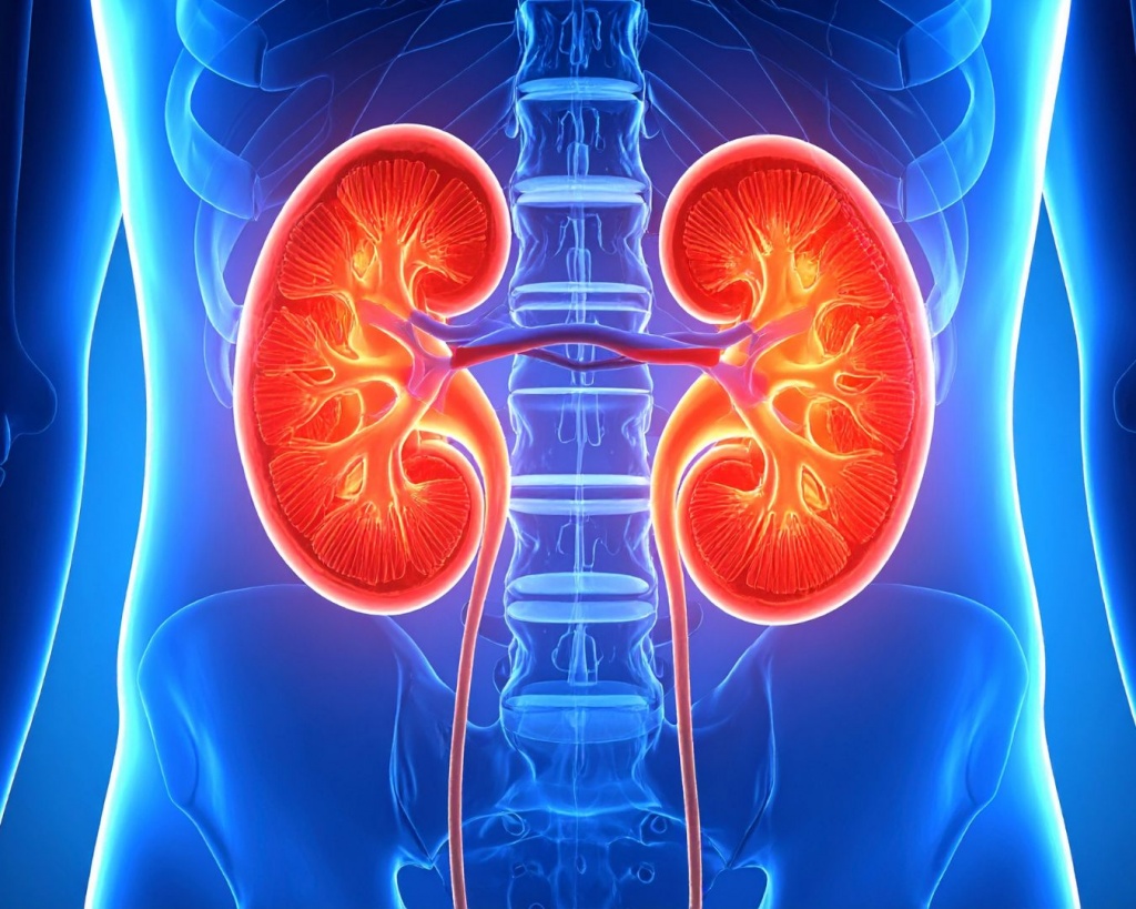 Лазерне дроблення каміння в нирках