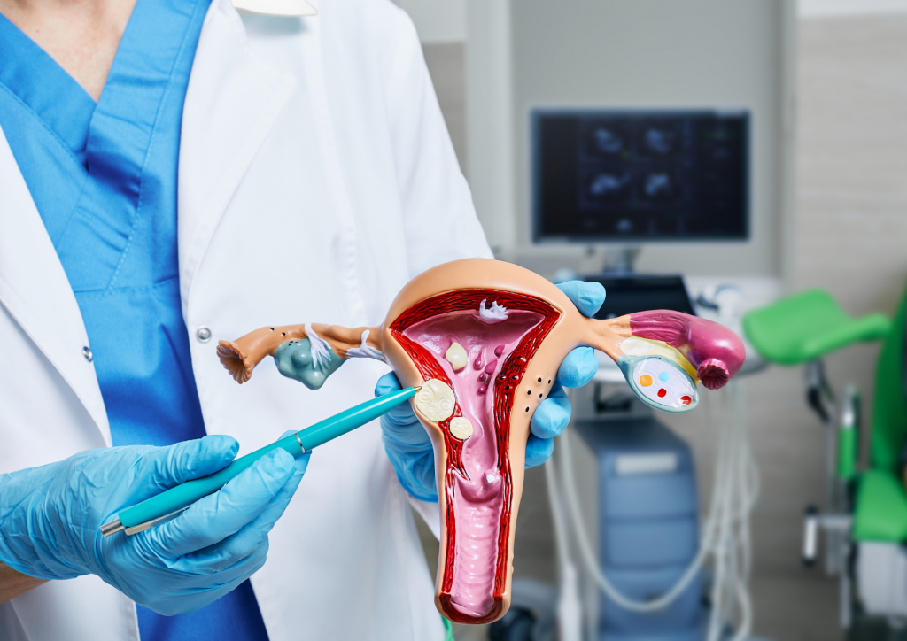 Що робити якщо поліп матки