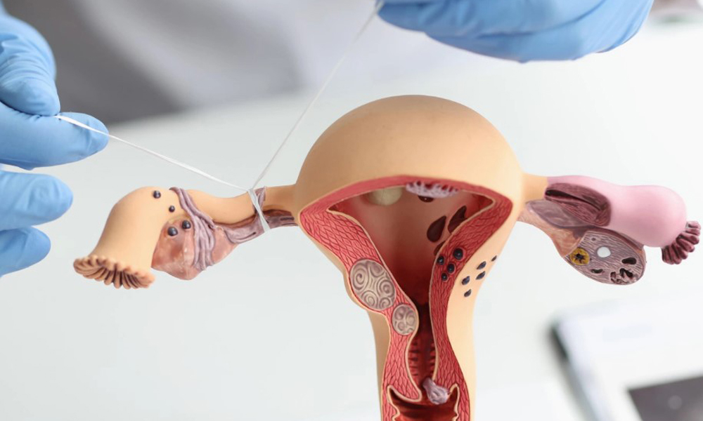 Жіноча стерилізація Житомир