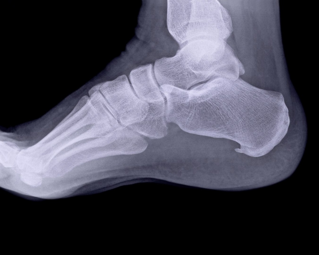 Рентген п'яти в Житомирі