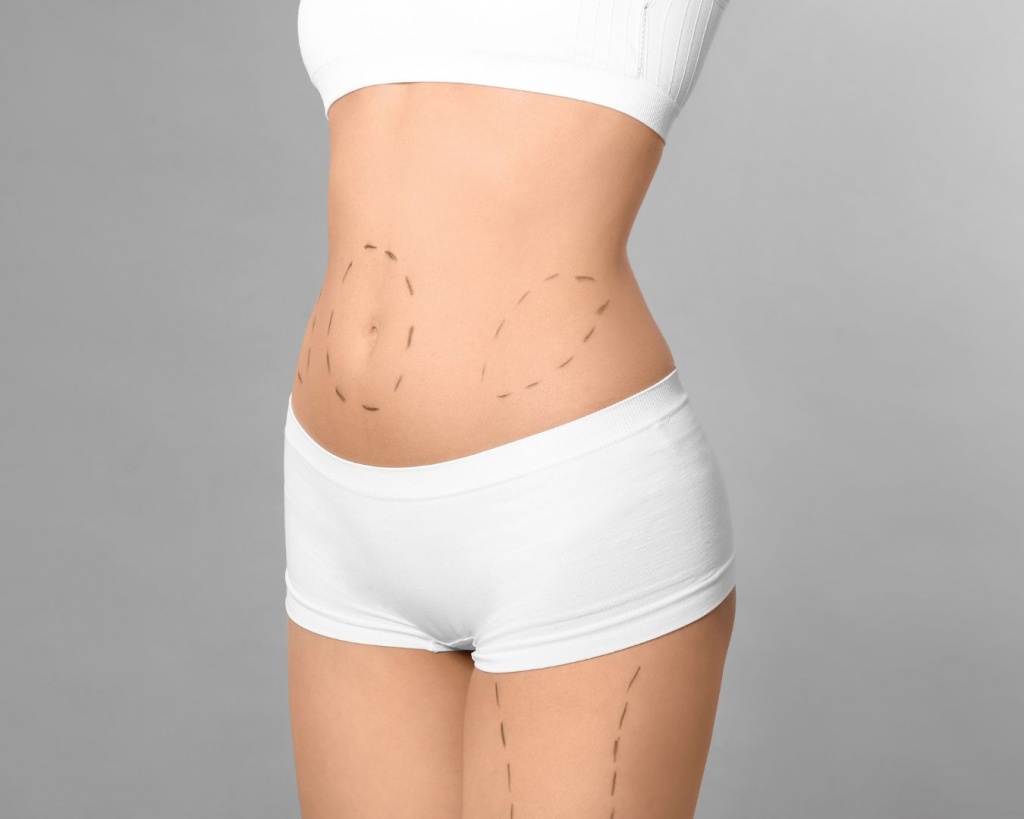 Боділіфтинг Житомир