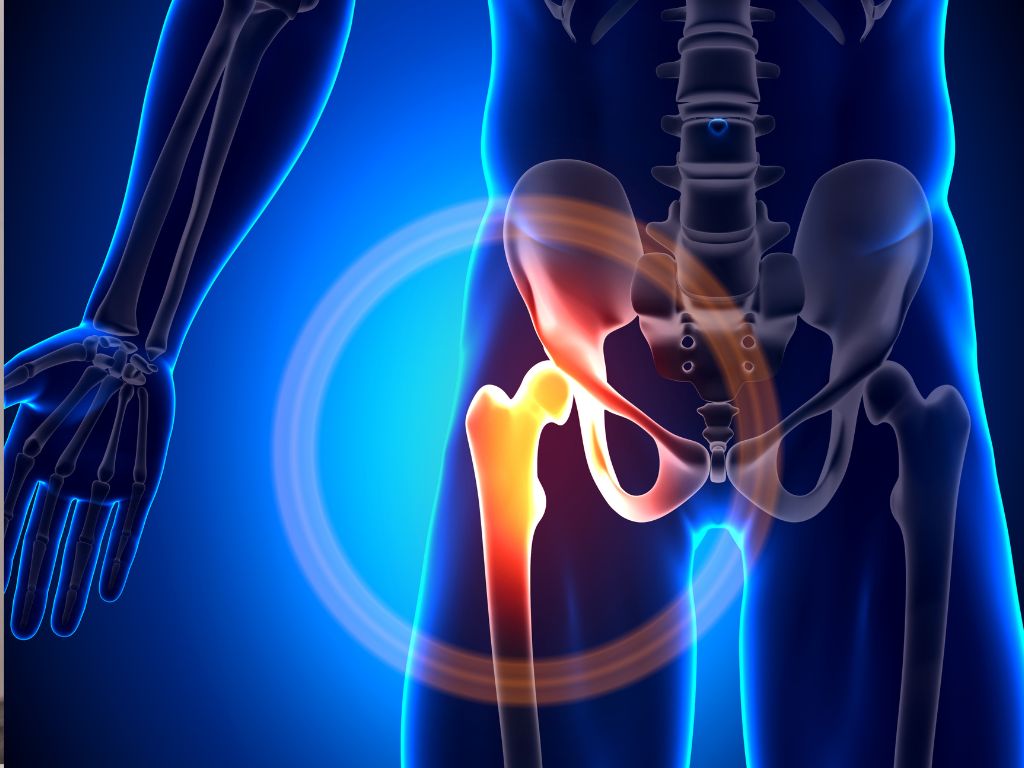 Встановлення штучного суглоба