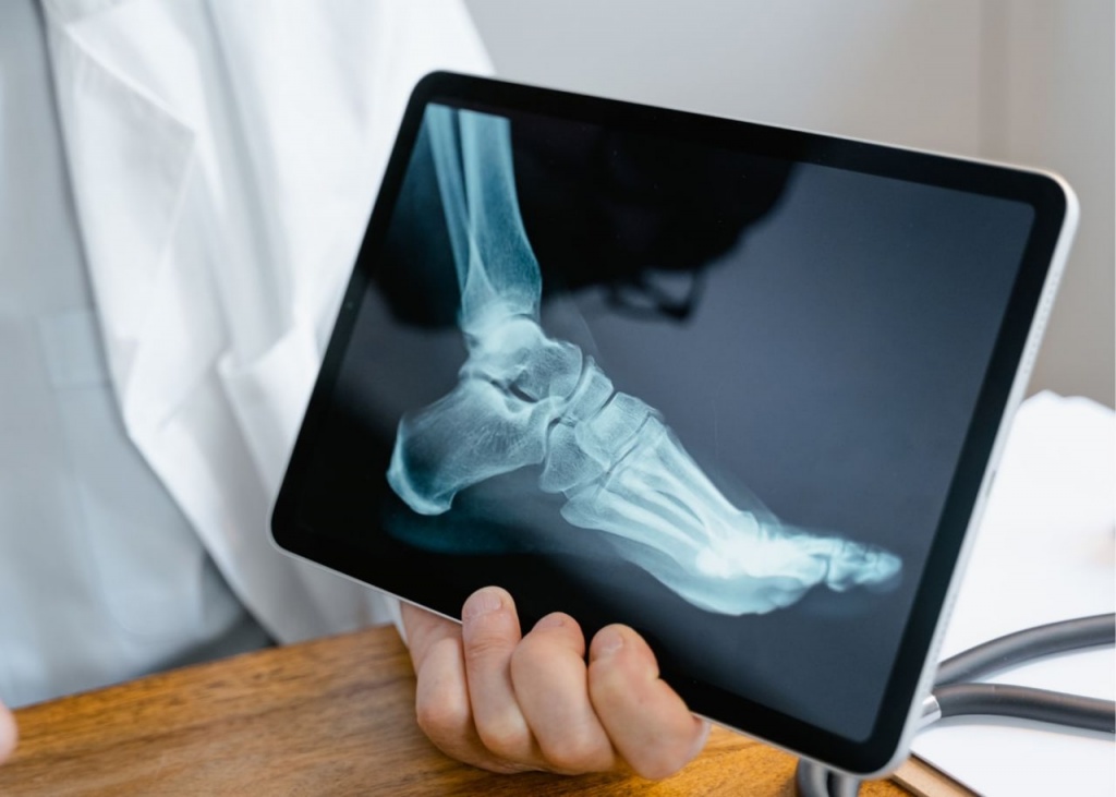 Цифровий рентген в Житомирі
