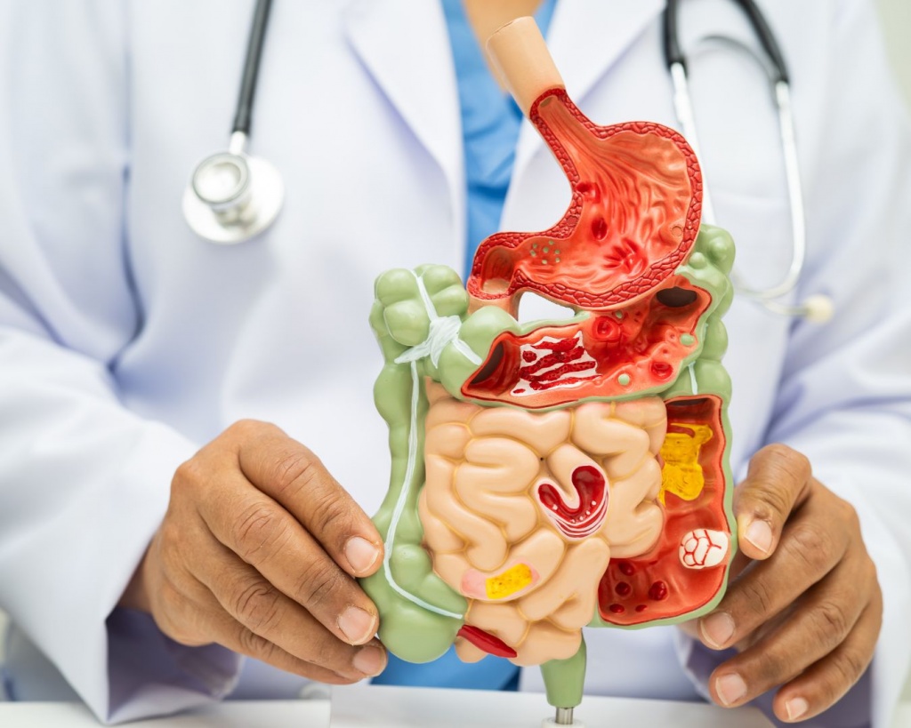 Перевірити травну систему