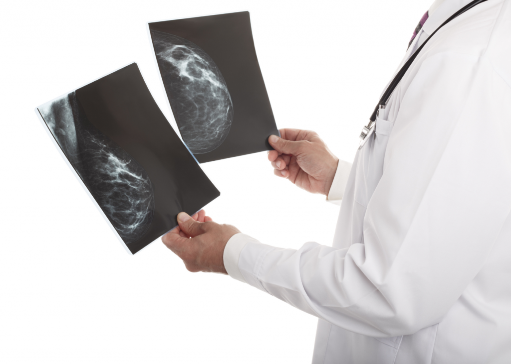Мамографія в Житомирі