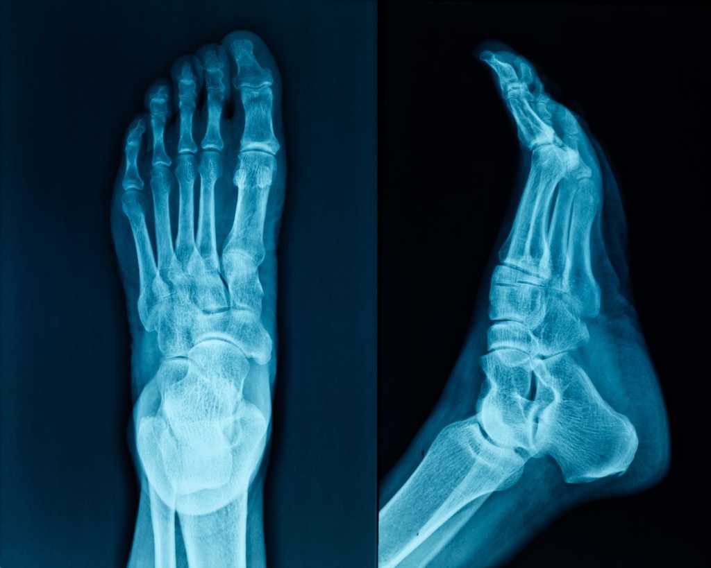 Рентген стопи Житомир