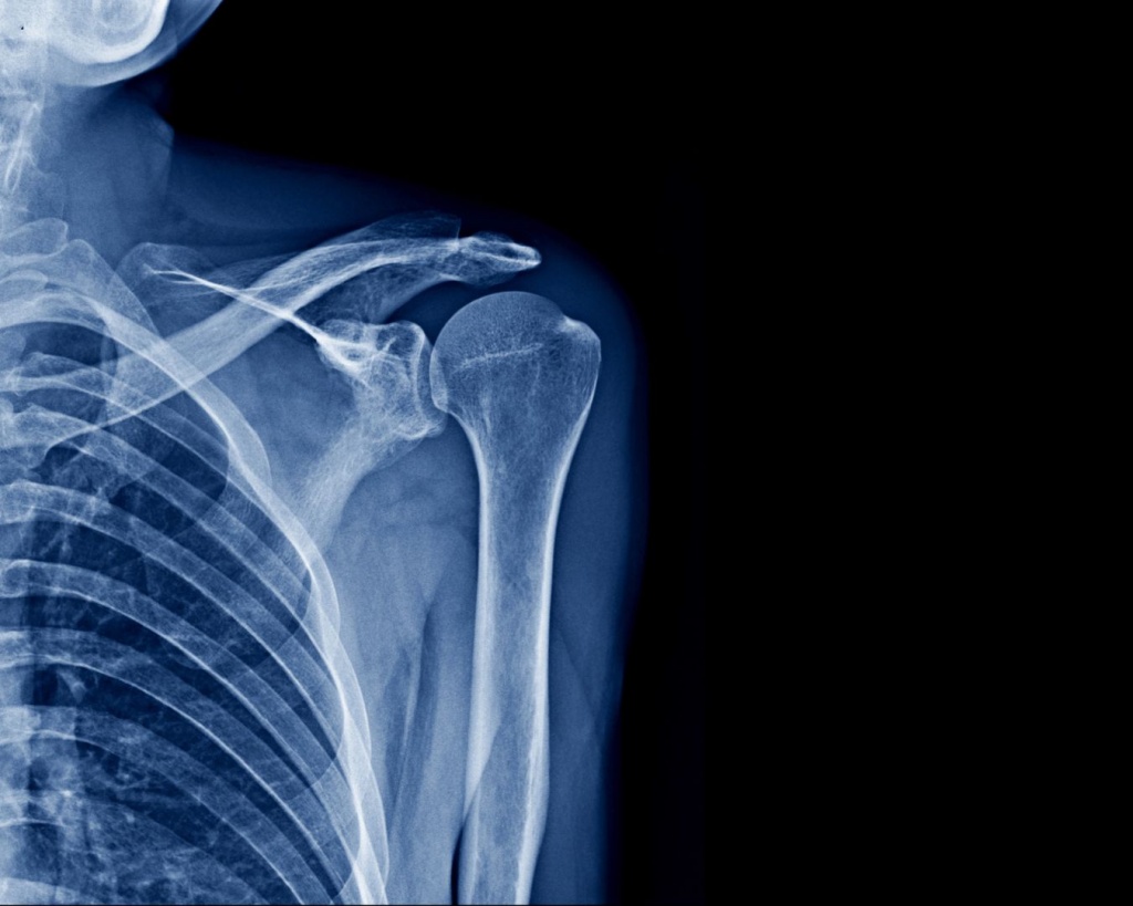 Рентген плеча в Житомирі