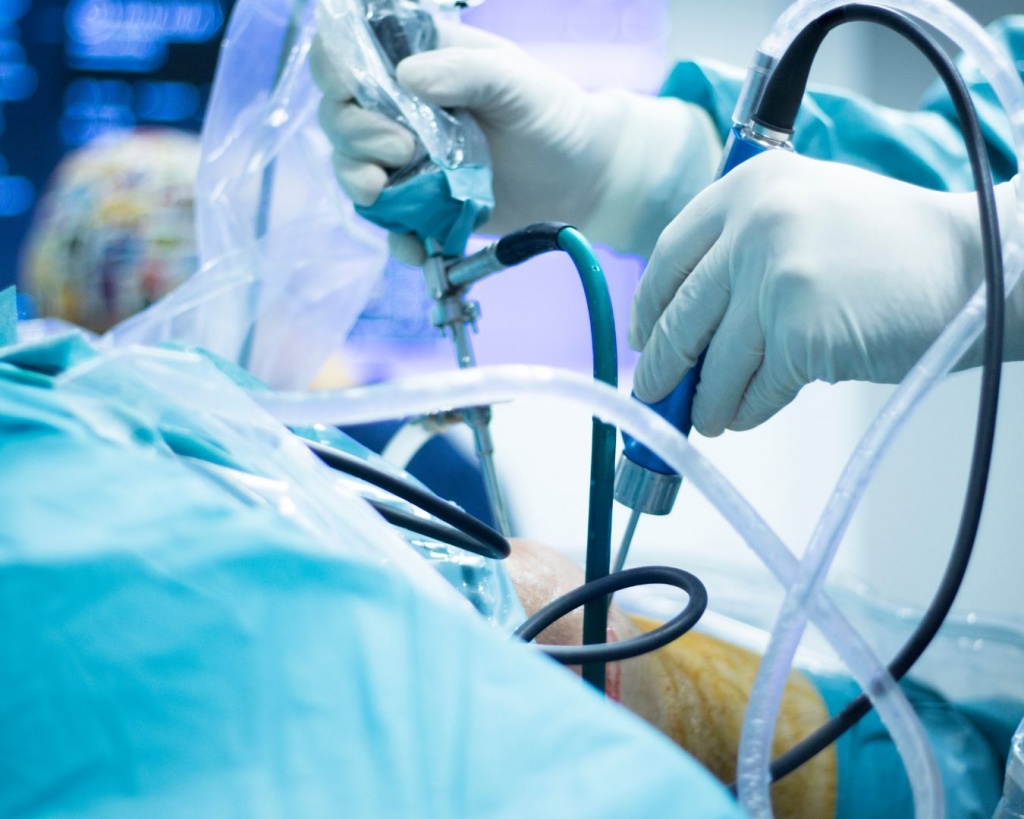 Як позбутися артрозу