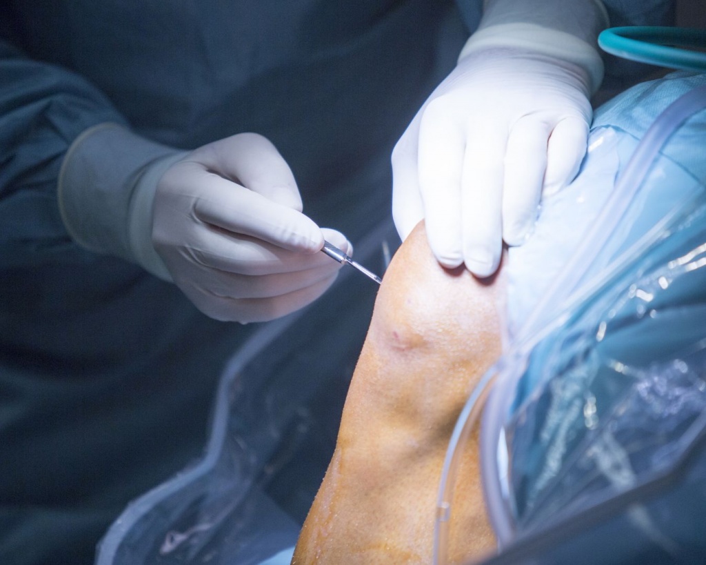 Сучасне лікування спортивної травми